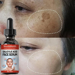 Niacinamide and Salicylic Acid Facial Serum Moisturizing Skin Care Products