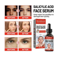 Sérum facial à la niacinamide et à l'acide salicylique Produits de soins de la peau hydratants