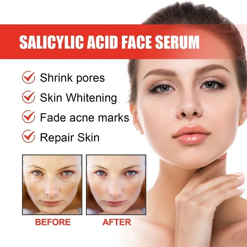 Niacinamide and Salicylic Acid Facial Serum Moisturizing Skin Care ProductsAzizaK