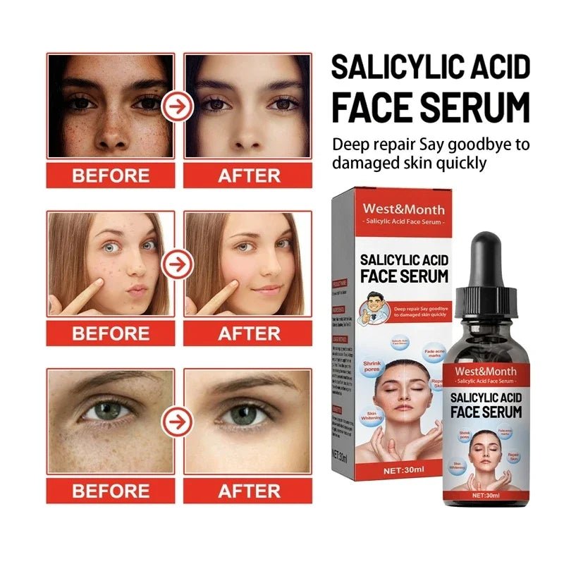 Niacinamide and Salicylic Acid Facial Serum Moisturizing Skin Care ProductsAzizaK